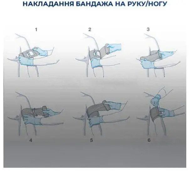 Ізраїльський компресійний кровоспинний бандаж 15 см (6 дюймов) з однією подушечкою версія PRO MHC-HD01 фото